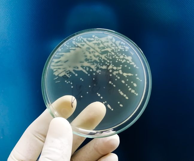 image of bacterial colonies on a plate